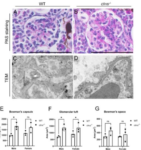 Cistanche treat kidney Disease Cistanche treat kidney Disease