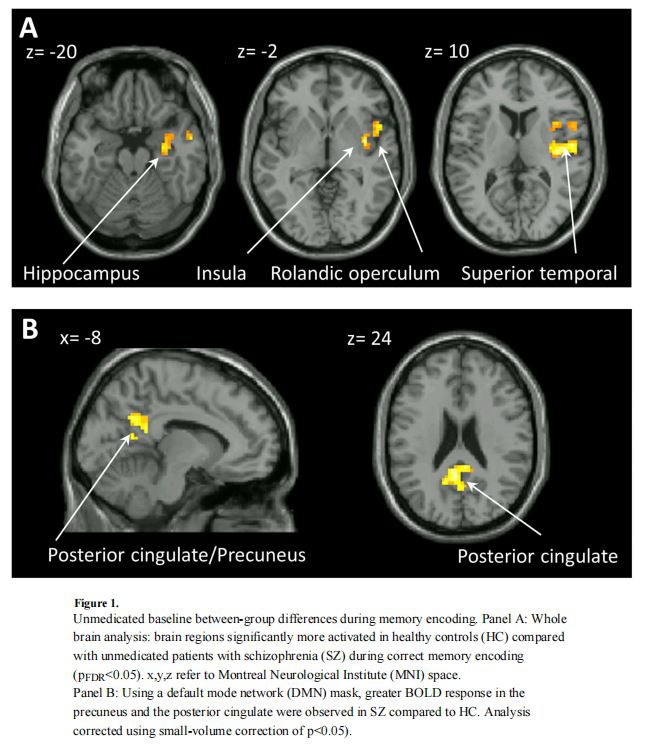 Unmedicated baseline