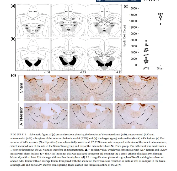 increase memory power